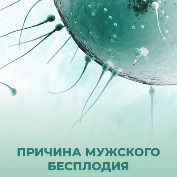 Причины мужского бесплодия: воспаления, стресс, образ жизни